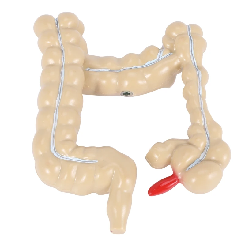 Colorectal Lesion Model Human Colon Large Intestine Pathological Diseases Mrganizer Anatomy |