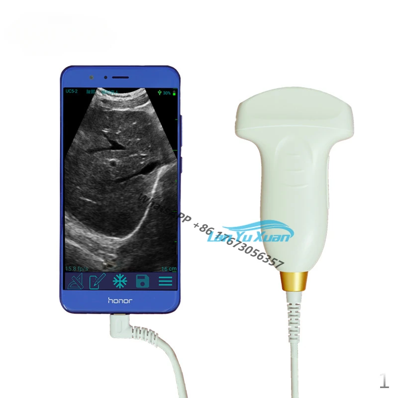 

128 Elements Wifi Ultrasound USG / Wireless Ultrasound Probe for IOS Android Mobile Device