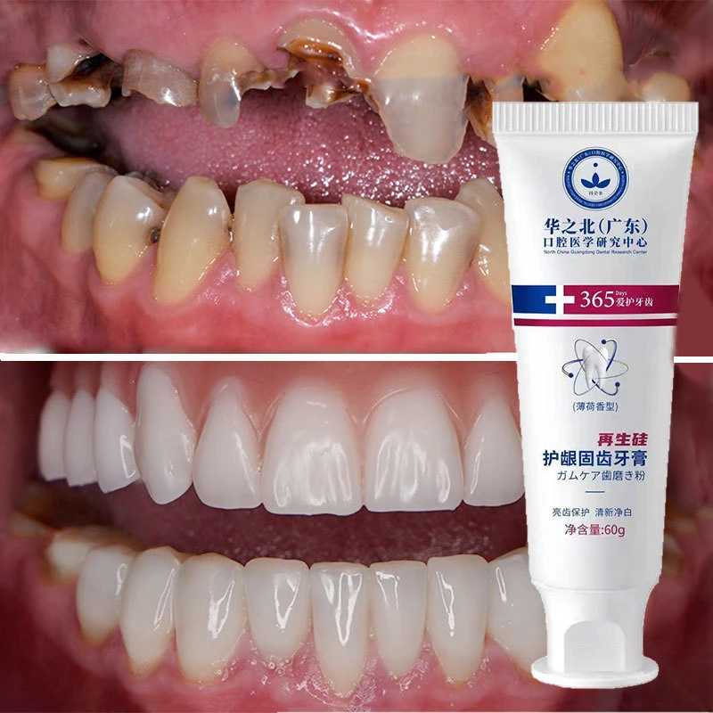 

Toothpaste Whiten Repair Gums Decay Cavities Caries Protect Teeth Removes Stains Plaque Fresh Breath Tooth Cleaning Products
