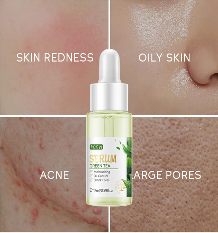

Green Tea Facial Essence Pore Shrink Oil Control Essence Whiten Improve Acne Blackhead Removal Dark Spot Dry Skin Care Cosmetics