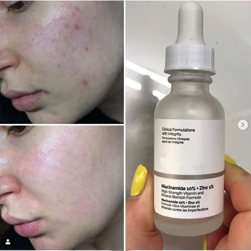 

30ml High Mineral Essence Niacinamide 10% + Zinc 1% Ordinary Regulates Sebum and Minimizes Pores Makeup Primer Facial Serums