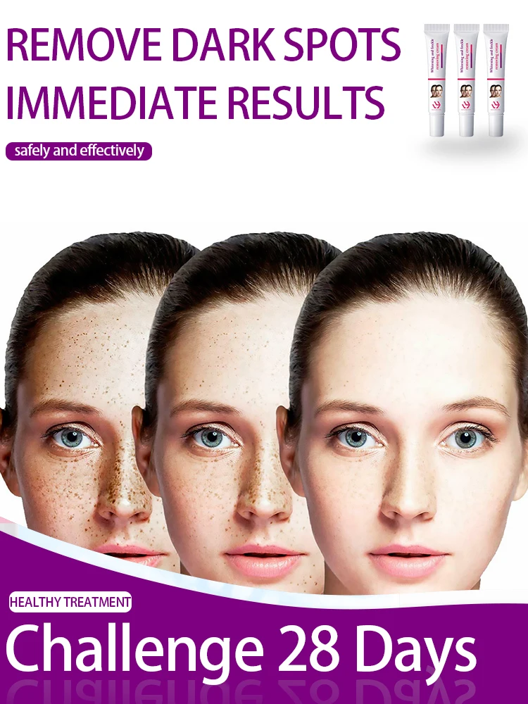 

Whitening and freckle removing cream