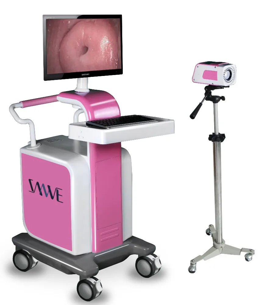 Electronic Digital Video Colposcope,Medical Colposcopy