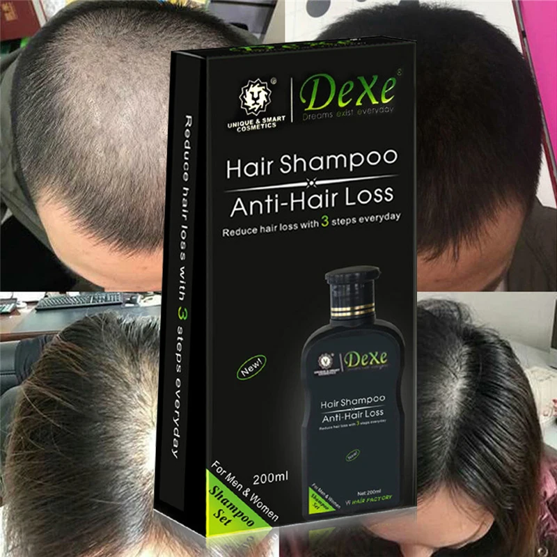 Dexe Professional hair growth Shampoo  Anti-hair Loss Chinese Herbal Hair Growth Product Prevent Hair Treatment