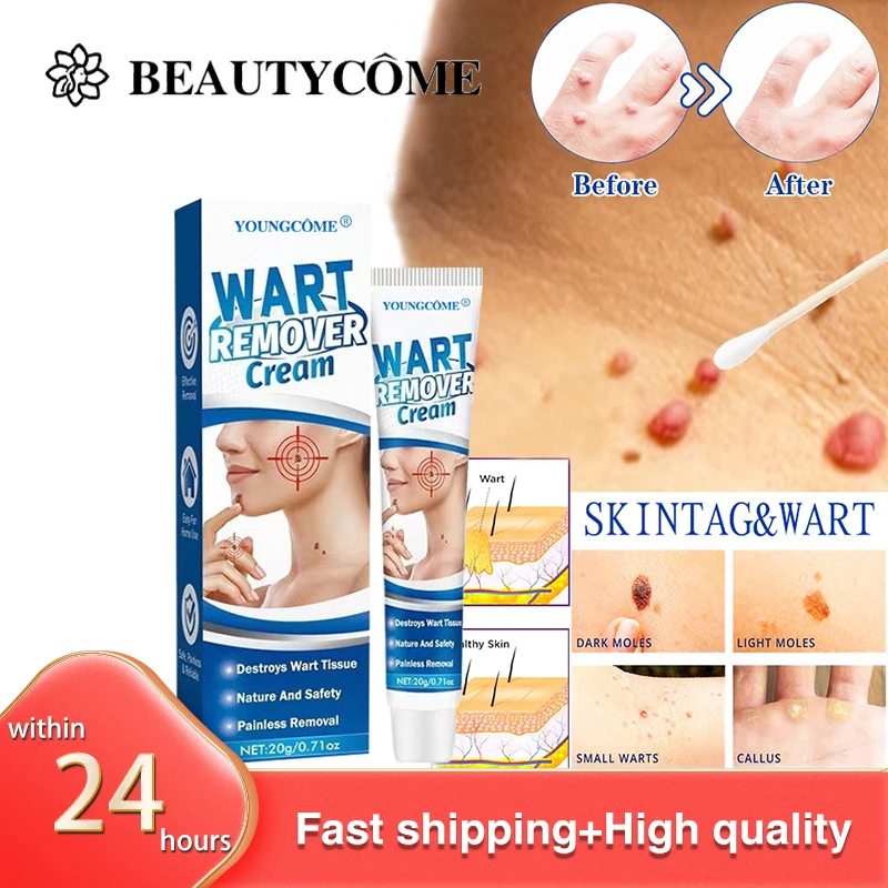 

Skin Tag Remover Cream Painless Mole Skin Dark Spot Warts Remover Serum Freckle Face Wart Tag Treatment Removal Essential Oil