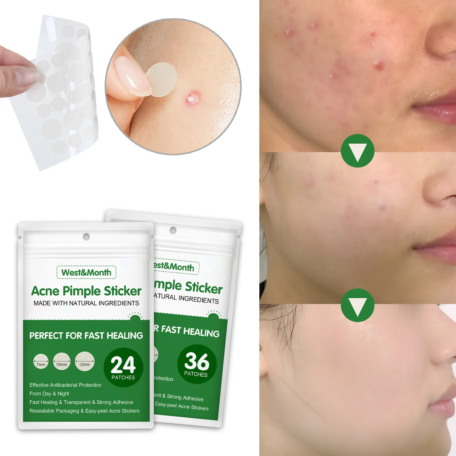 

Liquid absorption of acne skin paste to repair essential oils acne potion invisible waterproof Concealer breathable acne patch