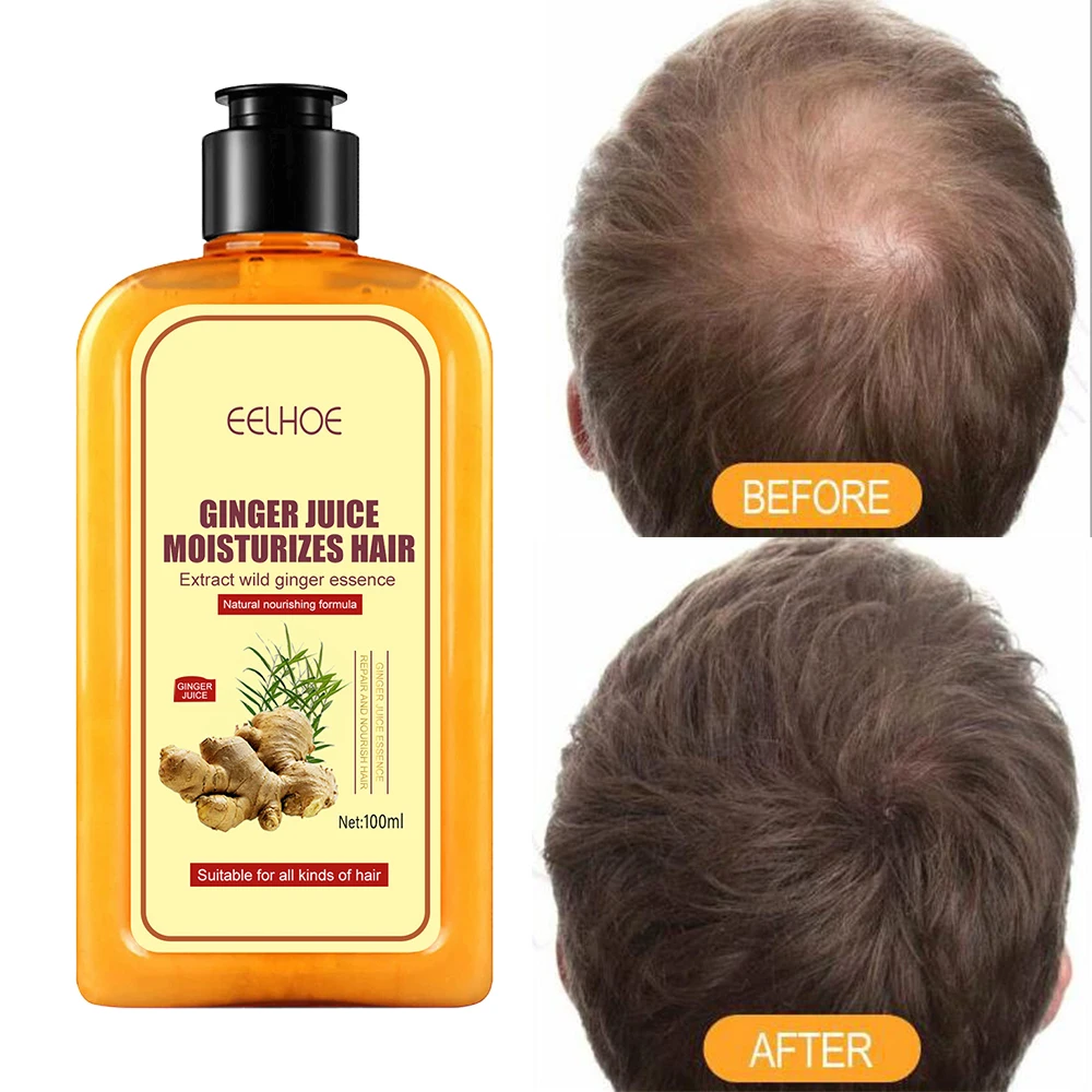 Ginger Anti-falling Shampoo 100ml Moisturizes And Repairs Hair Follicles Strengthens Hair Texture Prevents Hair Firming Shampoo