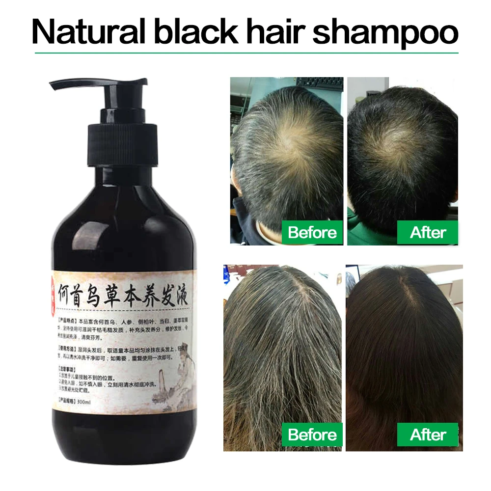 

Polygonum multiflorum shampoo white to black shampoo ginger shampoo Nourishing Shampoo 300ml