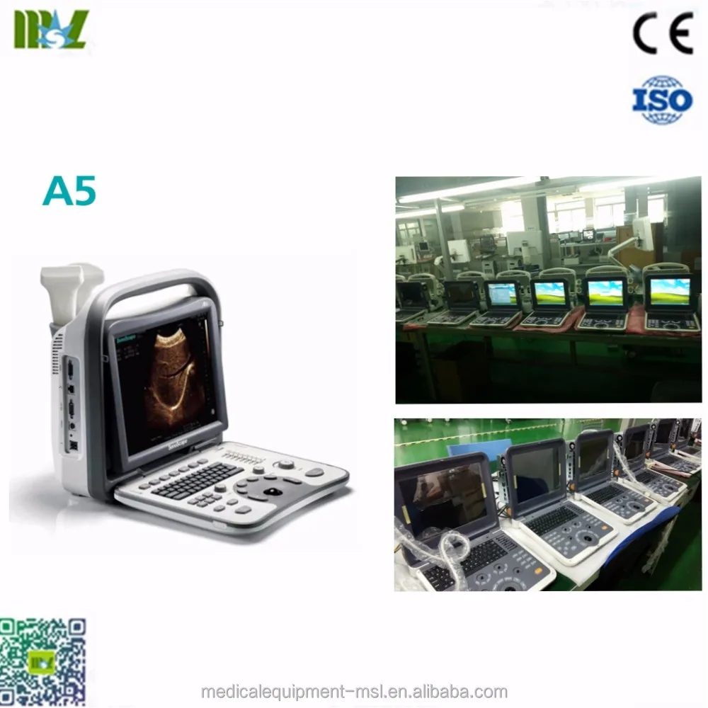 Запчасти для ультразвукового сканера Sonoscape A5