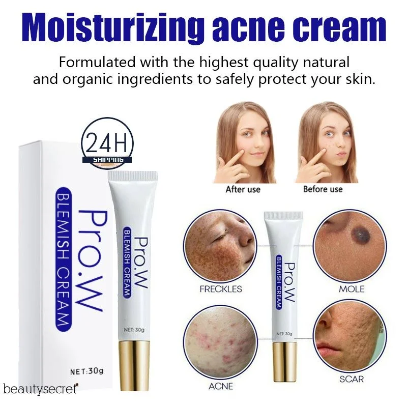 Pro.W Blemish Cream Acne Pimple Scar Dark Spots Removal Skin Whitening Brightening Face Cream 30ml {beautysecret}