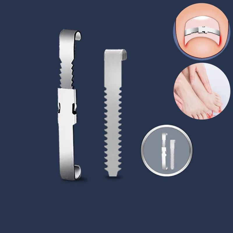 Средство для восстановления вросшей зоны ног инструмент ухода за ногтями