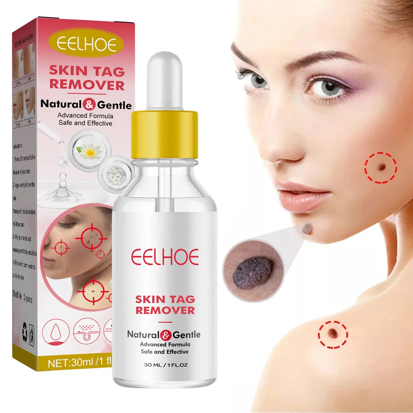

Foot Corn Removal Warts Thorn Foot Wart Treat Foot Wart Remover Essence Liquid Painless Skin Tags Mole Warts Remover Liquid