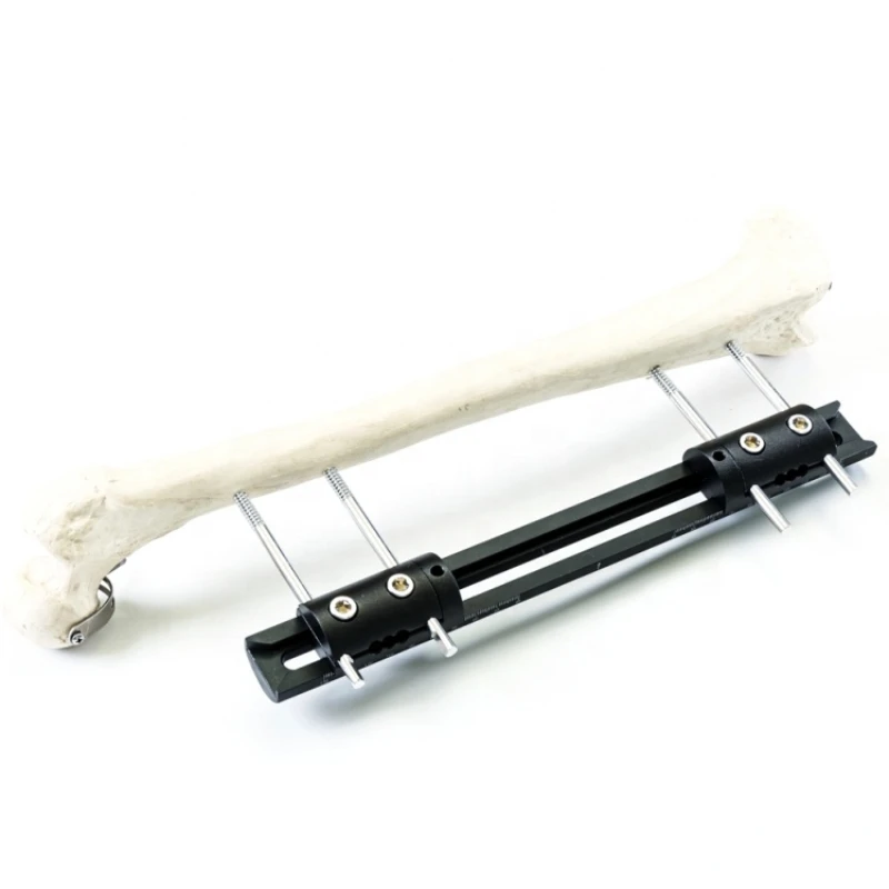 Удлинение костей внешний фиксатор фиксаторы для орального и бедренного излома