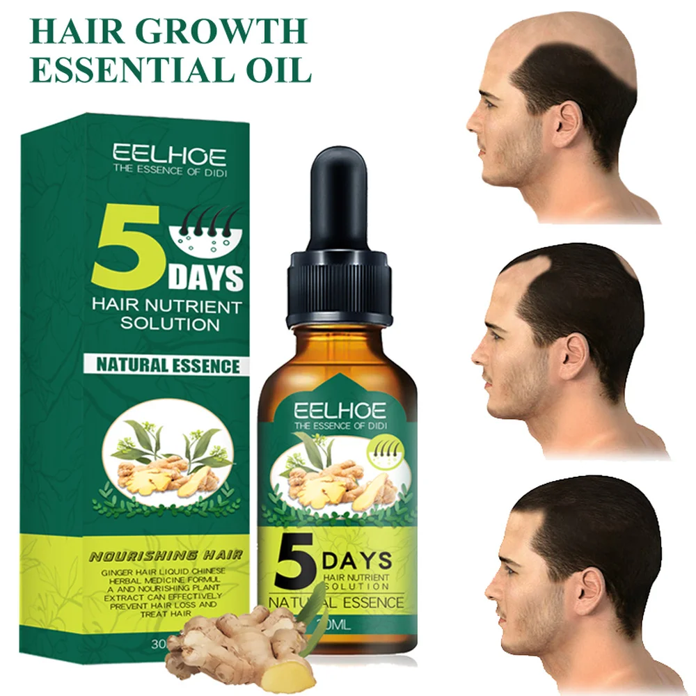 

Hair Loss Alopecia Fast Growth Ginger Essential Oil Hairless Baldhead High Hairline Increase Cream Head Nourish Lotion Essence
