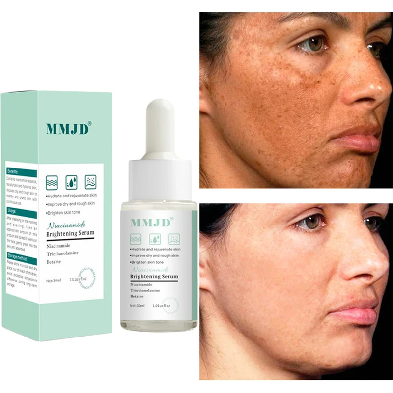 

Nicotinamide Whitening Freckles Serum Remove Dark Spots Melasma Lighten Melanin Brightening Moisturizing Essence Face Skin Care
