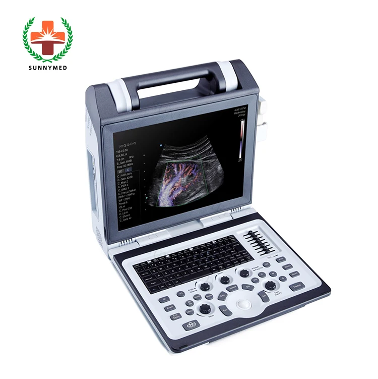 SY-A2100 Color Doppler Ultrasound 3D 4D Portable Ultrasound Machine For Pregnancy