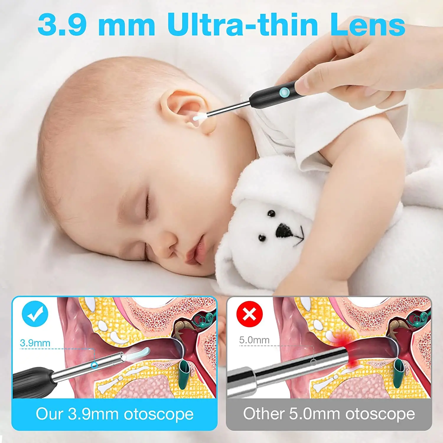 ВИТКОКО Беспроводной очиститель ушной серы с инструментом для камеры 1920P, 6 светодиодными лампами и диаметром 3,9 мм.