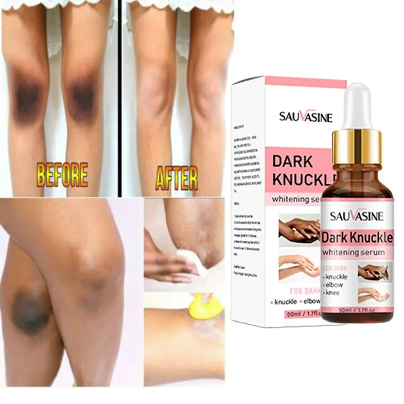 

Dark Knuckle Whitening Serum Face Butt Knee Body Skin Glow To Lightening Essence Whiten Inner Thigh Intimate Melanin Corrector