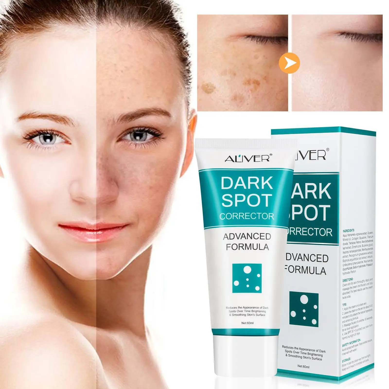 

60ml Dark Spot Corrector Cream Whitening Dark Spot Melasma Melanin Dark Spots Pigmentation remover Skin Care Face Cream
