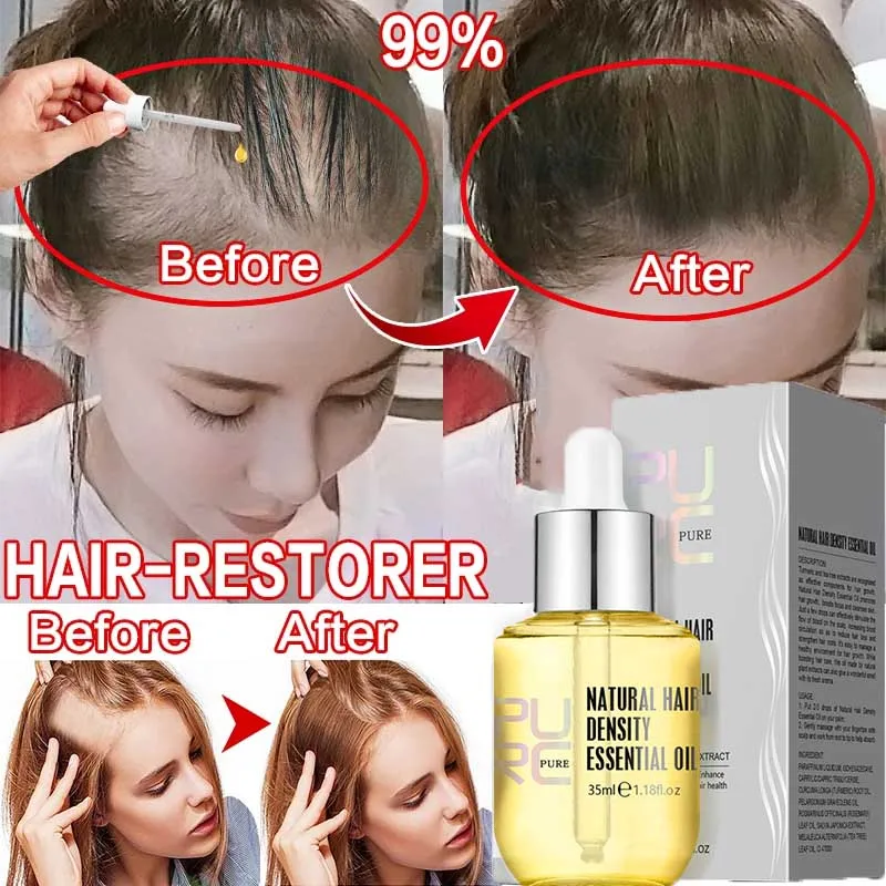 

PURC Ginger Essential Oil Hair Growth Serum Products For Men Women Fast Regrowth Hair Scalp Treatment Hair Grow Beauty Health
