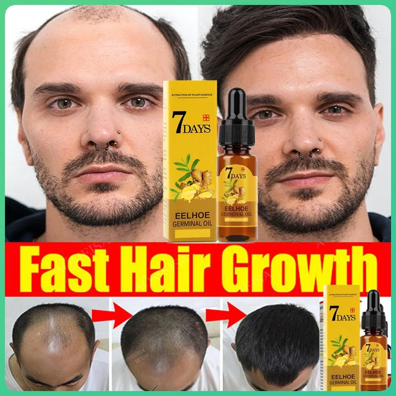 

Товары для роста волос, быстрорастущее эфирное масло, натуральное средство для ухода за кожей головы, выпадение волос, сухая сыворотка для восстановления поврежденных волос для мужчин и женщин