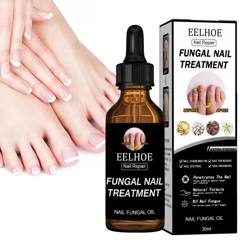 

Sdotter Nail Renewal Solution Extra Strong Finger And Toenail Fungi Therapy Nail Therapy Essence Oil To Repair And Protect Toena
