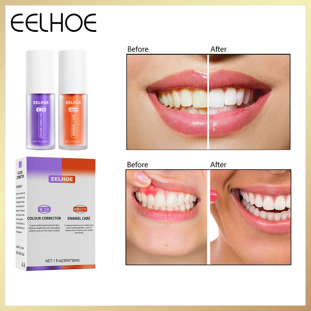 

30ml Corrector Toothpaste Stain Removal Teeth Whitening Toothpaste Cream Remove Teeth Stains Tools Portable Whitening Gel