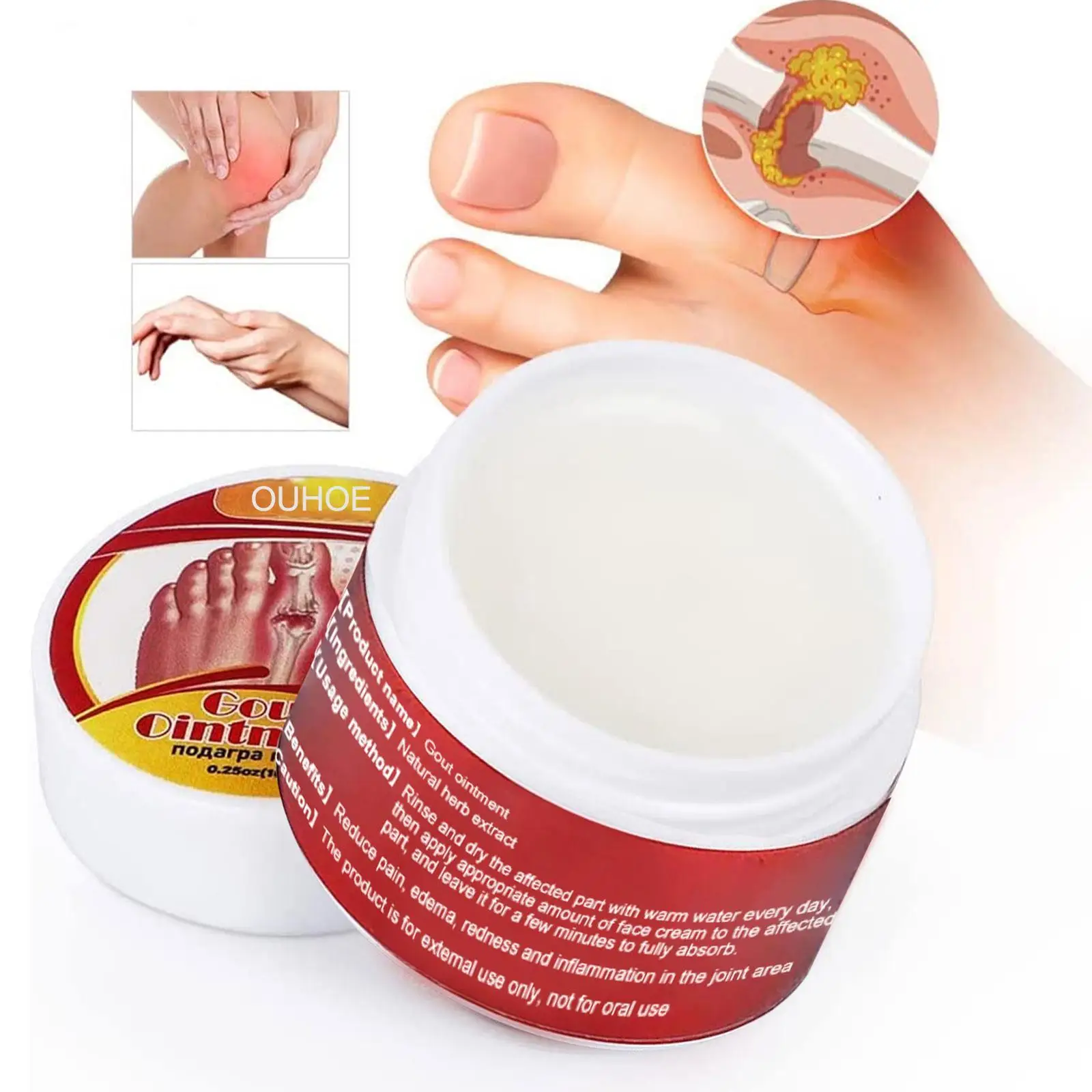 

10g Gout Treatment Ointment Toe Joint Valgus Corrector Cream Thumb Hallux Finger Arthritis Pain Relief Medical Plaster for Foot