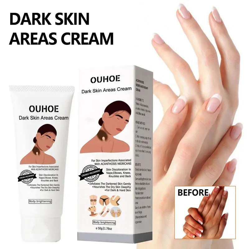 

Inner Thigh Lightening Cream Fast-Acting Skin Lightening Cream Black Spot Remover For Inner Thighs Armpit Neck Whitenings Cream