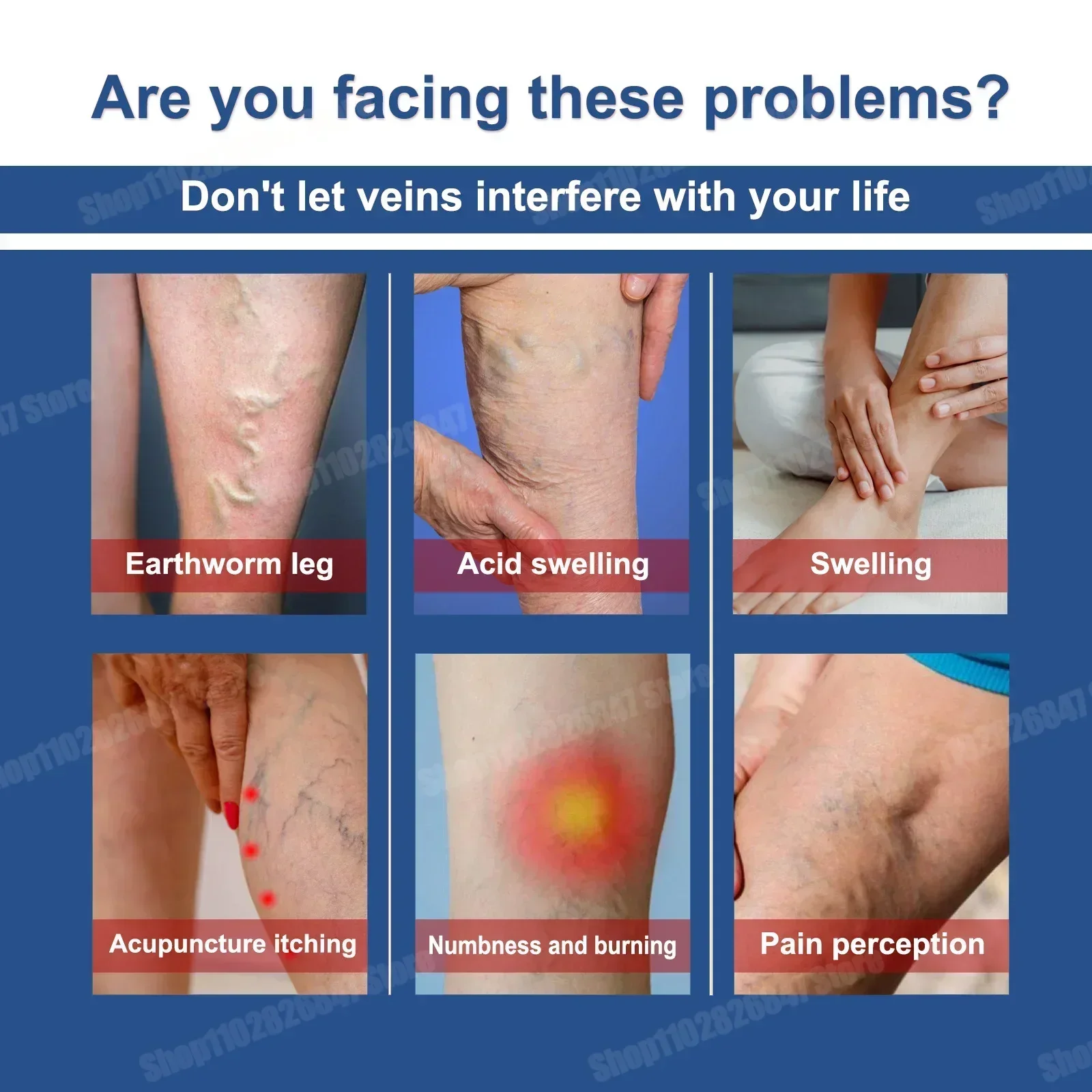 Надежный спрей для варикозного расширения вен натуральные травы успокаивающий с