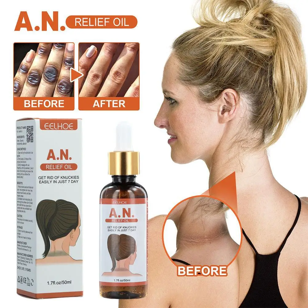 

50ml Acanthosis Nigricans Therapy Oil Dark Spot Corrector Oil Dark Knuckle Whitening Serum For Removing Dark Knuckle Joint B4N9