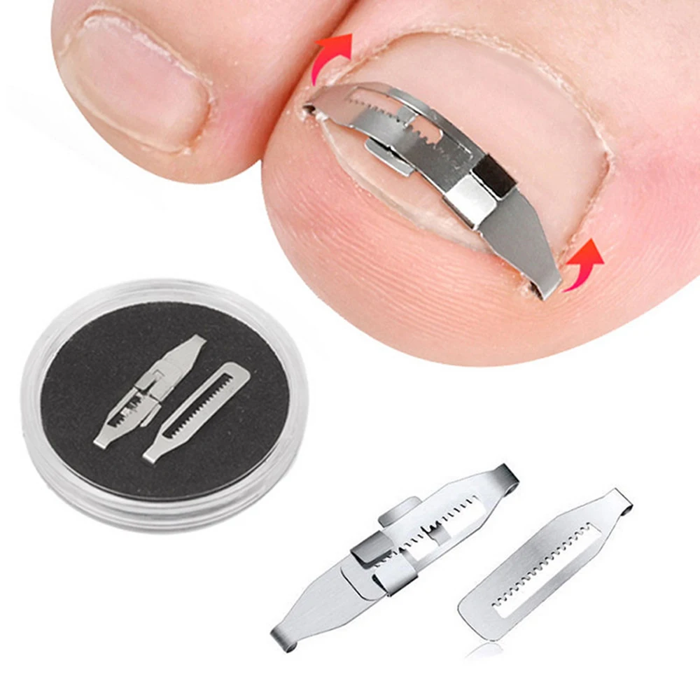 

Ingrown Toe Nail Correction Tool Paronychia Cure Toenail Recover Corrector Clip Relief Pain Pedicure Stainless Steel Foot Care