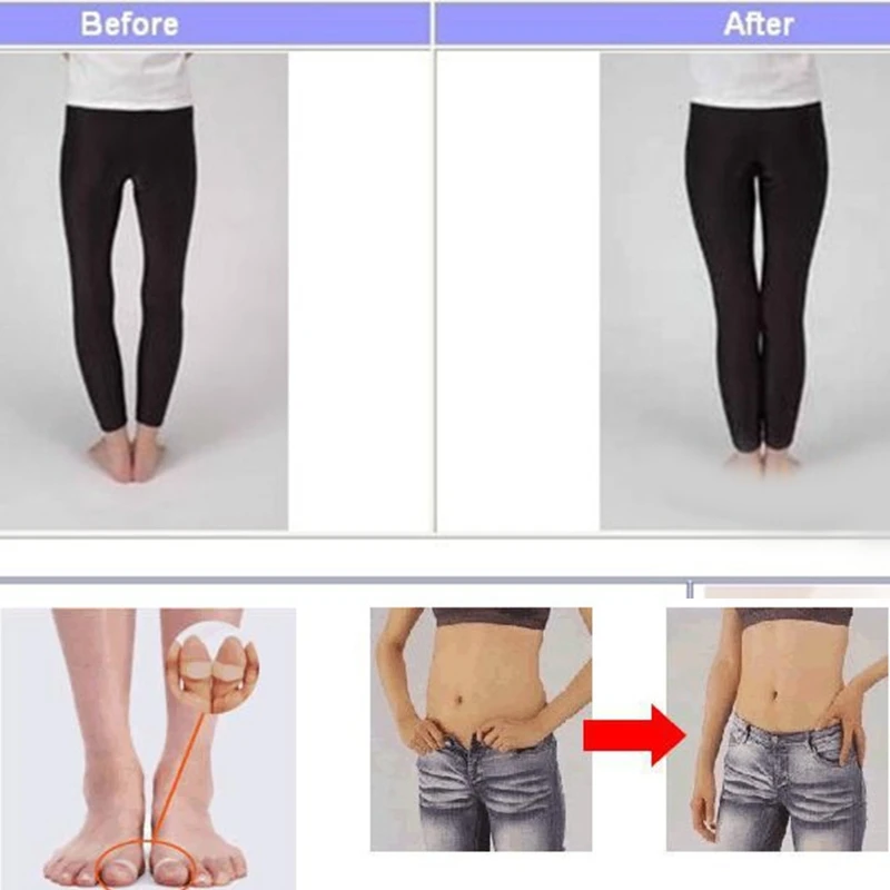 

K1KB 2x Body Slimming Toe Rings Silicone Magnetic Toe Rings Weight Loss Tool Burning Fat Toe Rings Keep Fitness Toe Rings