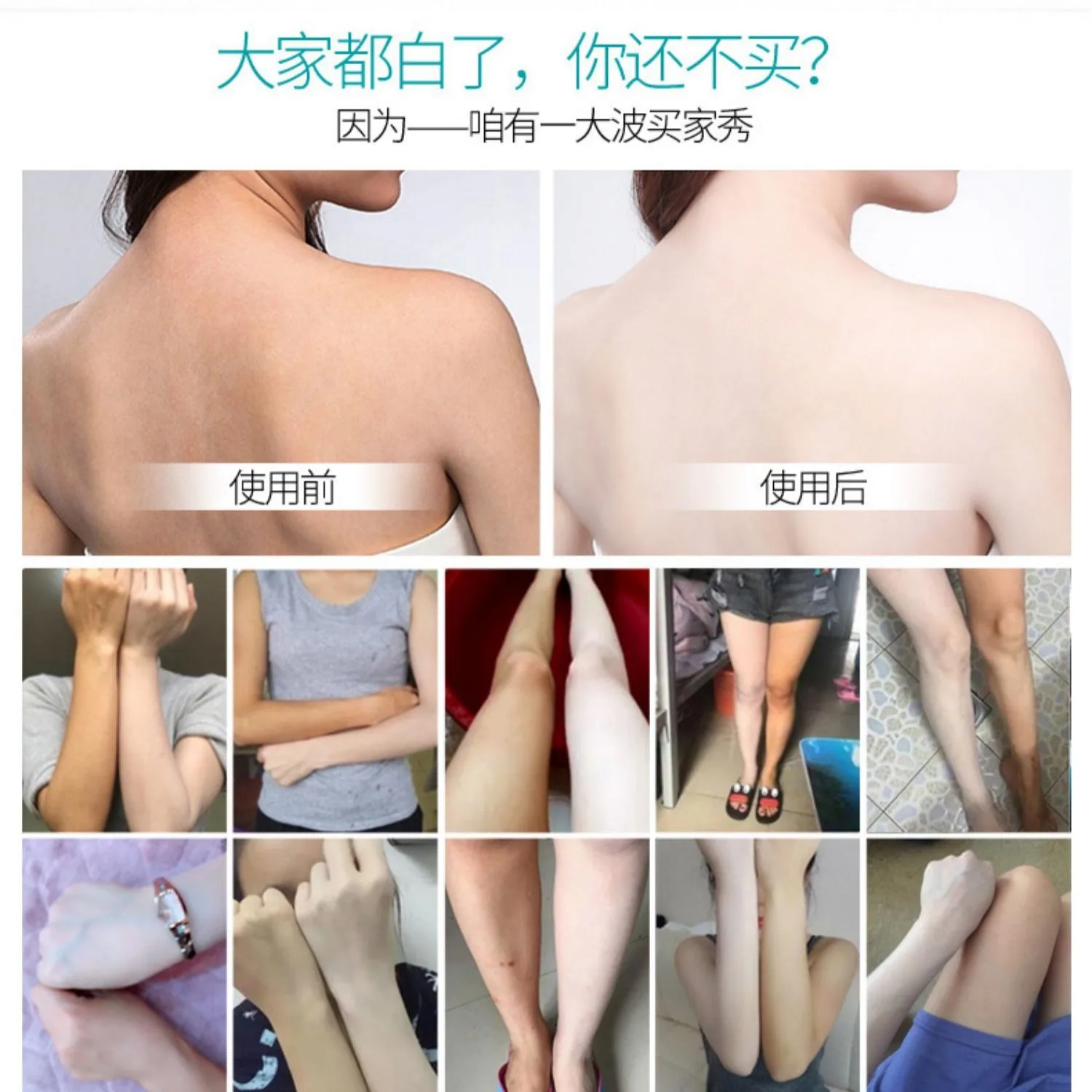 Отбеливающий крем Niacinamide для кожи удаления пигментации лосьон ухода за телом