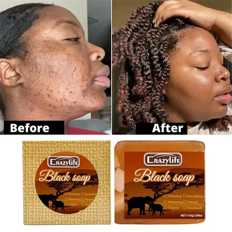 

Body Bar Soap Dark Skin Remover Soap With Shea Butter Non-Greasy Facial Skincare Shower Helper Soap For Dark Elbows Back Acne