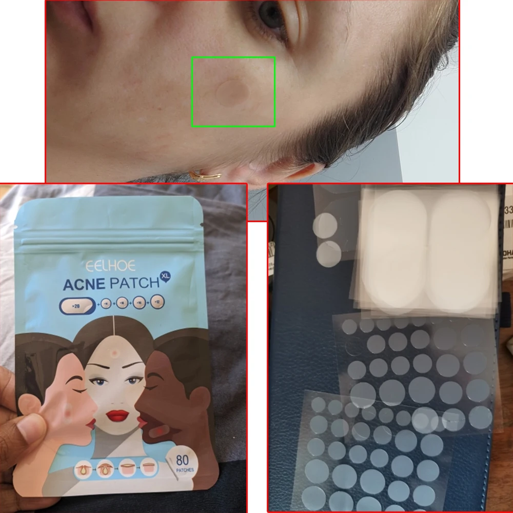 Патчи Гидроколлоидные для удаления черных точек на лице 80 шт. |