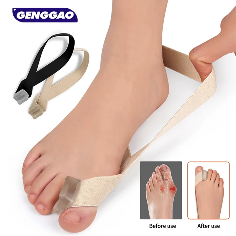 1 шт. магнитный сепаратор ремня-нехирургическая коррекция вальгусной деформации