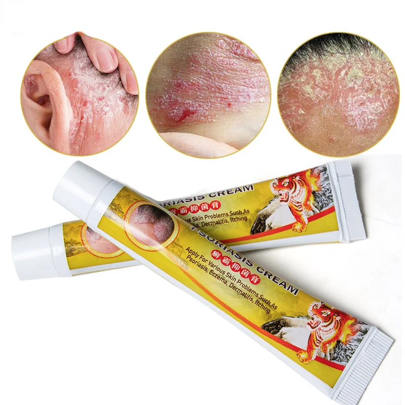 

Tiger Balm Eczema Cream Psoriasis Antibacterial Dermatitis Pruritus Eczematoid Herbal Anti-itching Medical Ointment