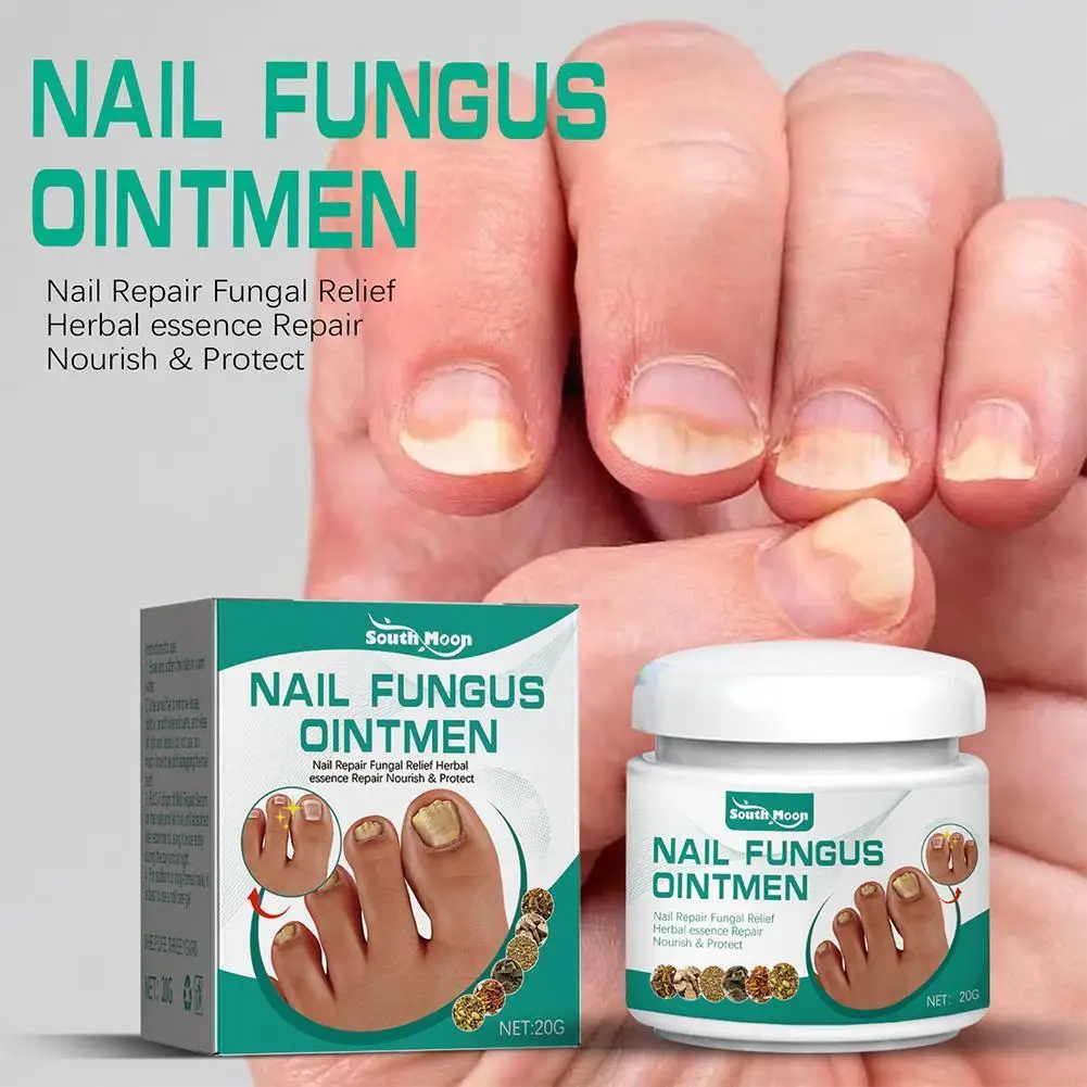 

20g Nail Fungus Treatment Very Stronger Removal Feet Nail Infection Care Onychomycosis Toe Paronychia Foot Cream Anti Powde E1V5