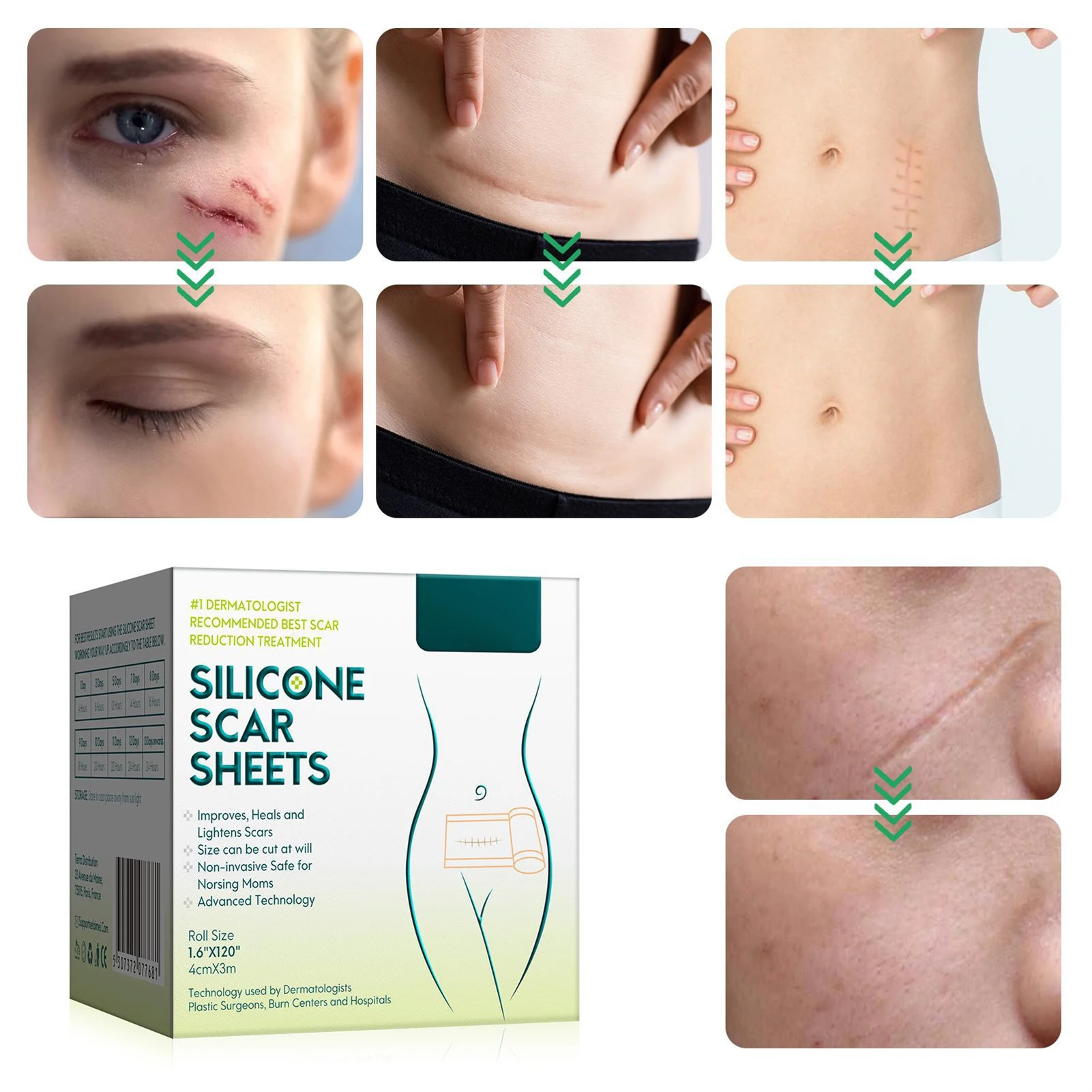 

Silicone Scar Tape Skin Tone Silicone Gel Patch Bandage Invisible Artificial Skin Patch Soft Silicone Tape For Surgery Scars
