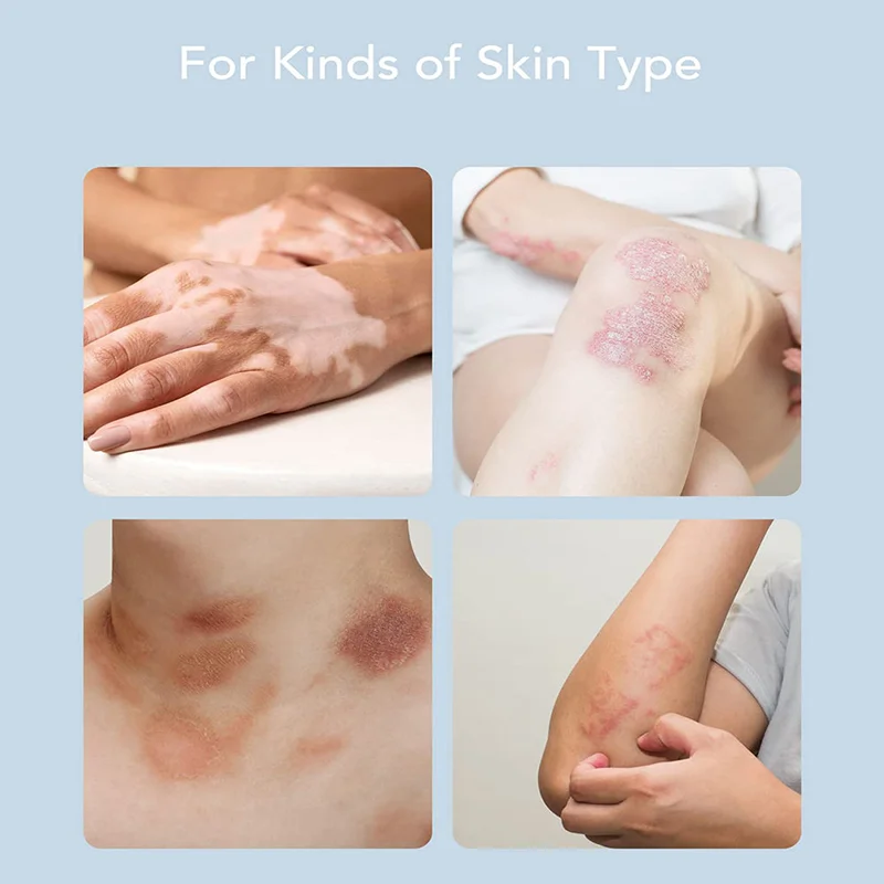 Инструмент для лазерной терапии уфв Нм