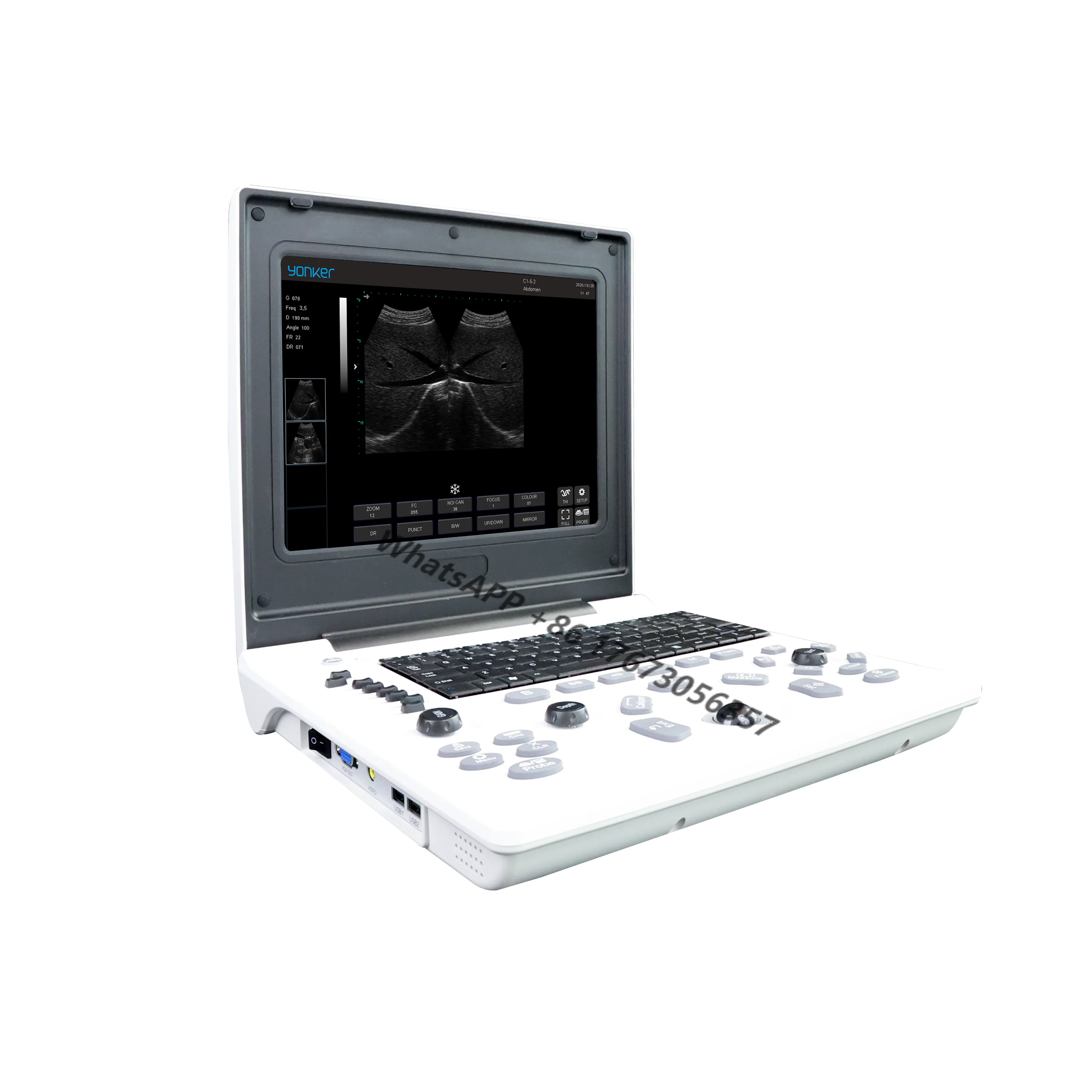 

Thyroid and breast examination cheap probe ultrasonic black and white hospital clinic portable ultrasound machine