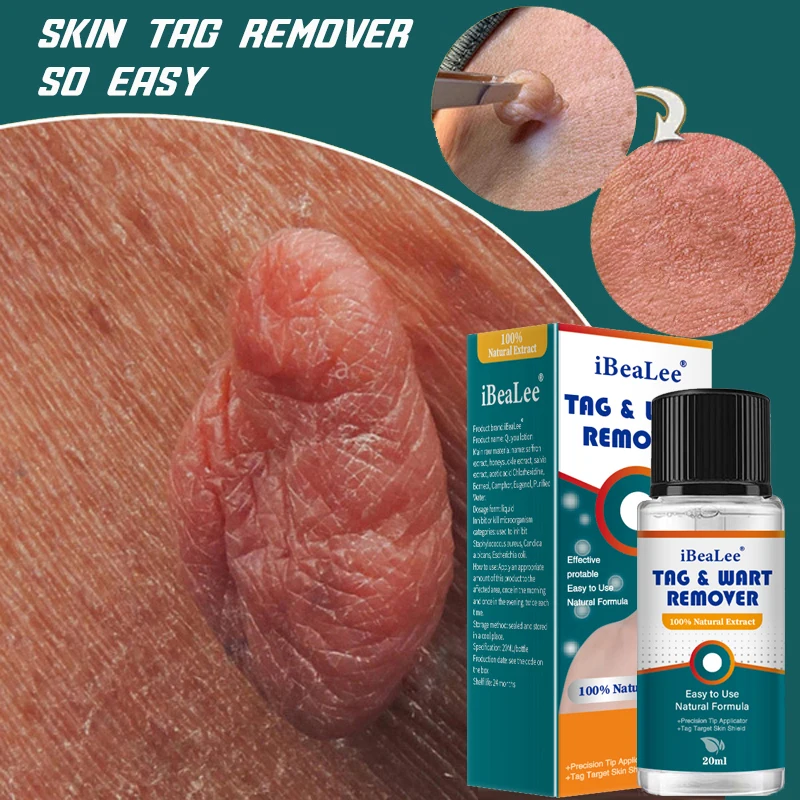 

iBeaLee Skin Tag Remover Painless Mole Skin Dark Spot Wart Removal Serum Freckle Face Tags Treatment Remove Cream Essential Oil