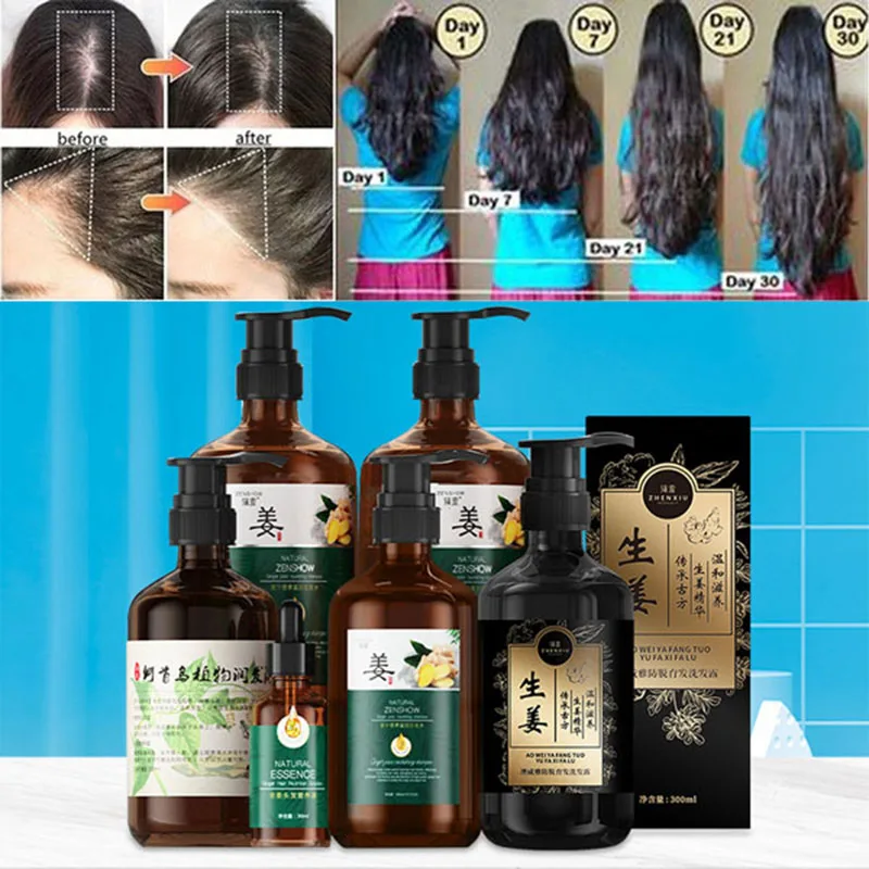 Natural Hair Growth Products Hair Care Ginger Shampoo Anti Hair Loss Fast Growing Prevent Baldness Repair Scalp Frizzy Damaged