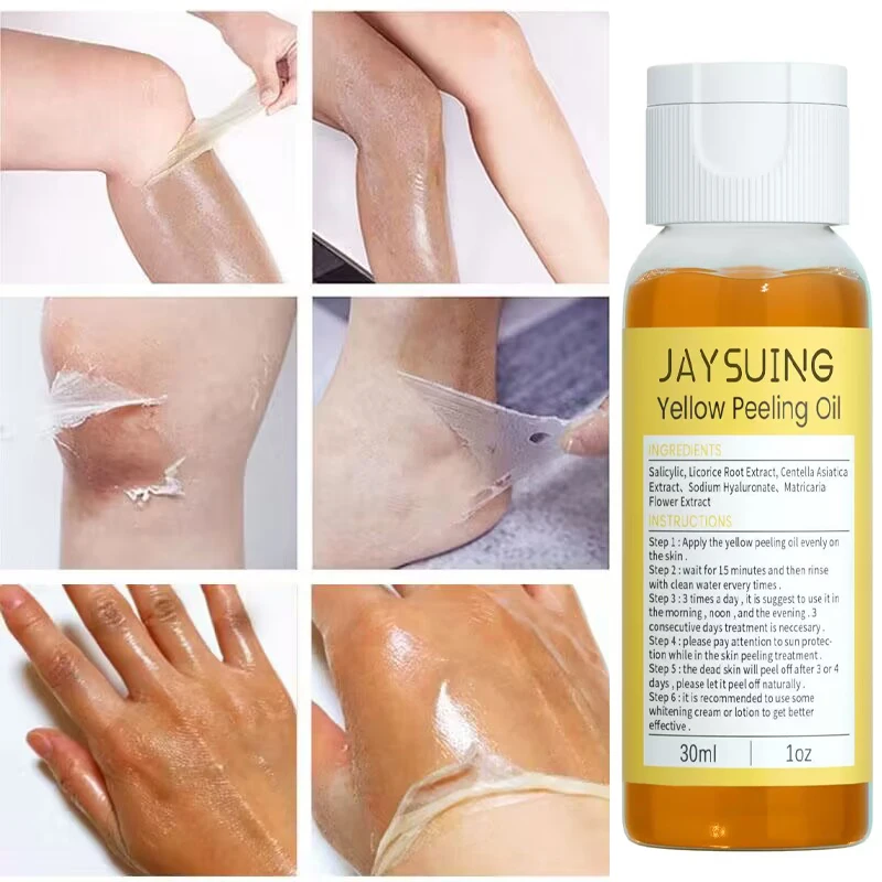 Yellow Peeling Oil Dark Skin Bleaching Remove Arm Knee Legs Melanin Body Exfoliation Brightening Whitening Beauty Skin Care 30ml