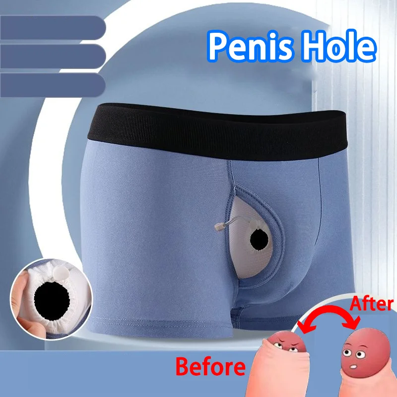 Man Penis Pouch Underwear Front Open Boxers Foreskin Enhancing Sexy Bulge Lingerie Health Care Glan Expose Hole Sheath Trunks