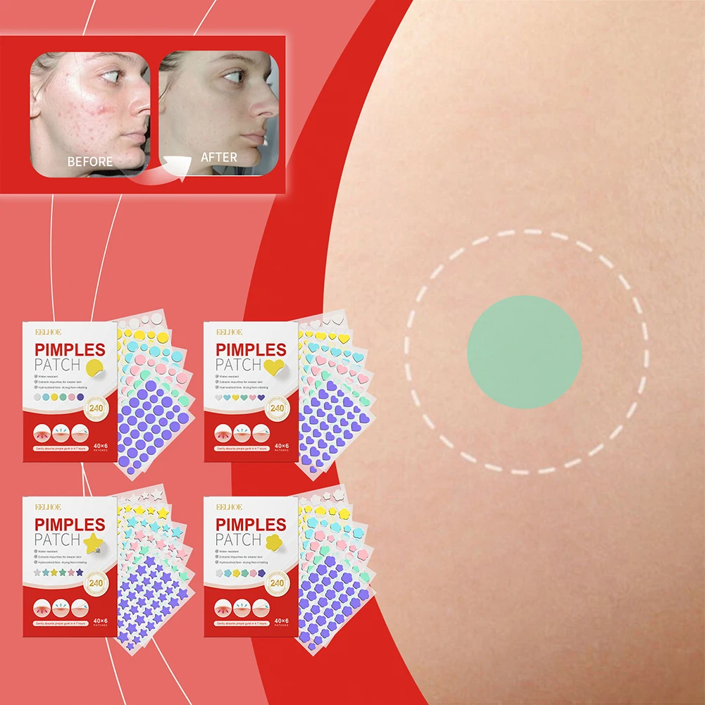240 шт. пластыри от акне и прыщей круглые/в форме сердца/цветка/звезды