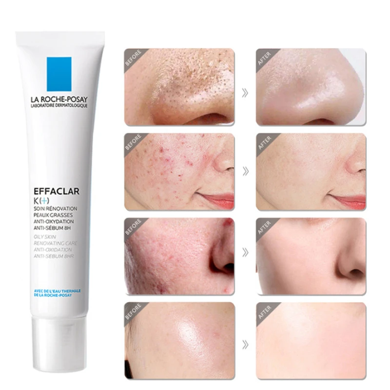 

La Roche Posay EFFACLAR K+ Acne Treatment Salicylic Acid Gel Removal Pimple Blackhead Shrinking Pore Whitening Repair Face Cream