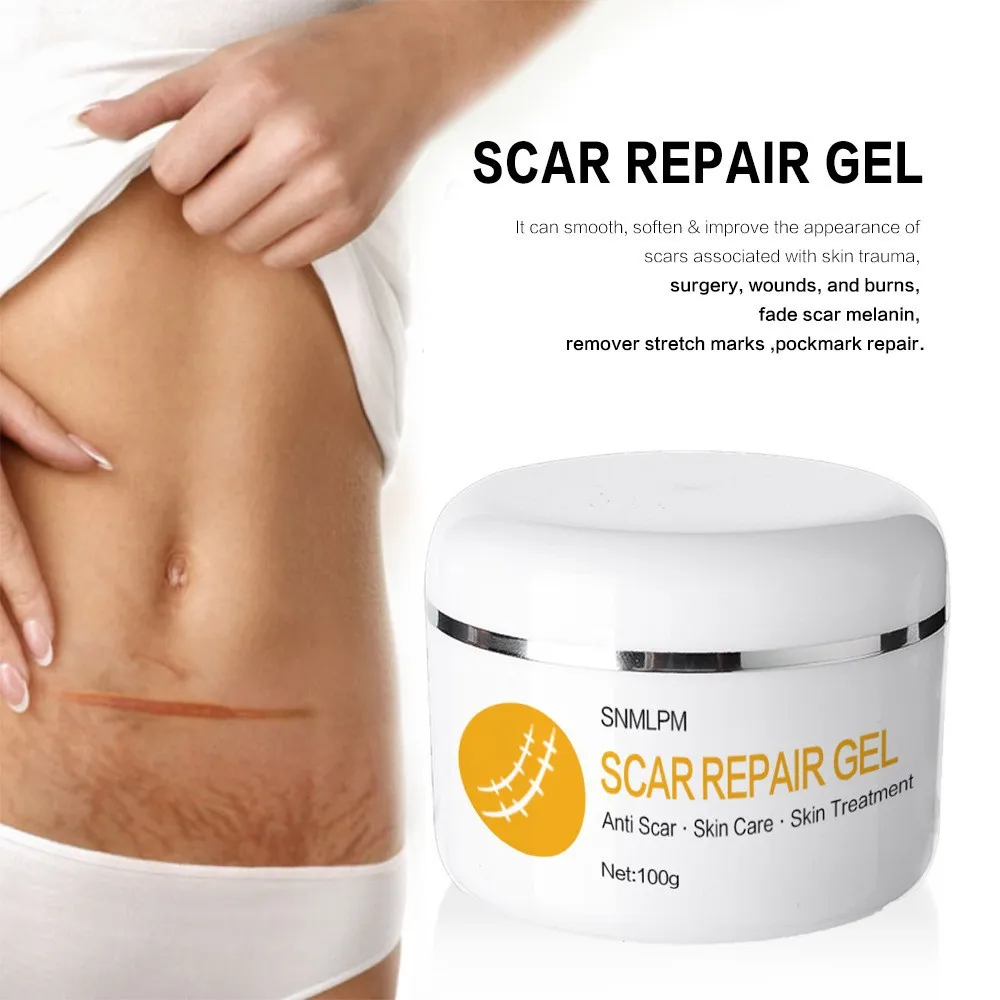 100ml Caesarean Scar Fall Scar FADE SCARMELANIN SURGERY Repair Cream Repair No Trace Scar Remover Cream Free Shipping