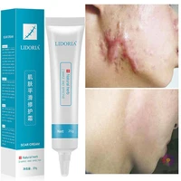 herbal scar removal cream gel stretch marks anti acne scar burn surgical scars treatment smooth whitening face repair products